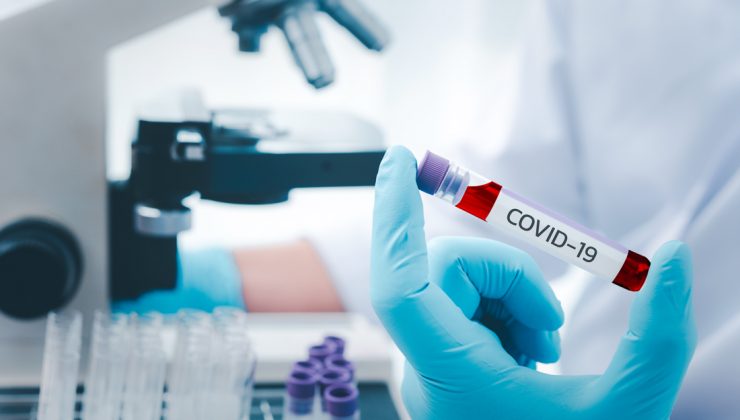 Ochorenie COVID-19 zostáva hrozbou