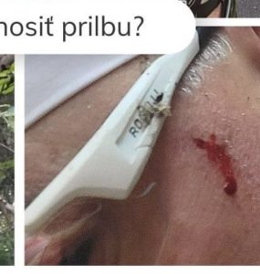 Andrej Kiska sa zranil