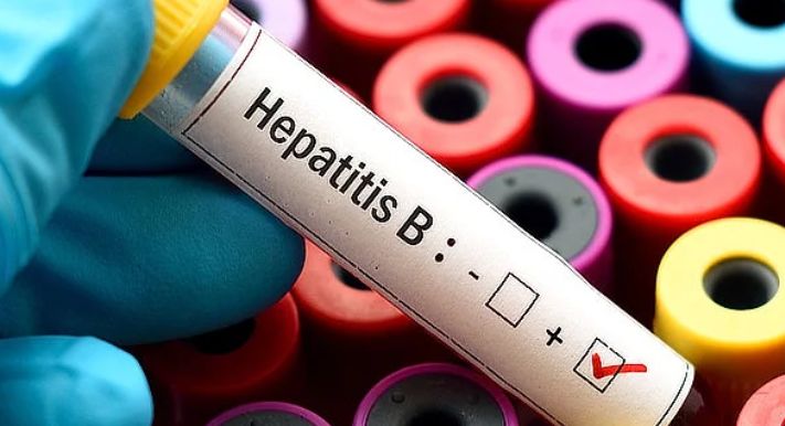 Vírus hepatitídy B